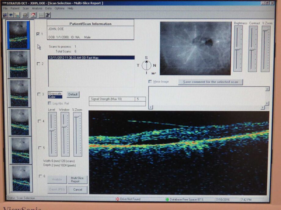 CARL ZEISS Stratus OCT III 3000 Tomography