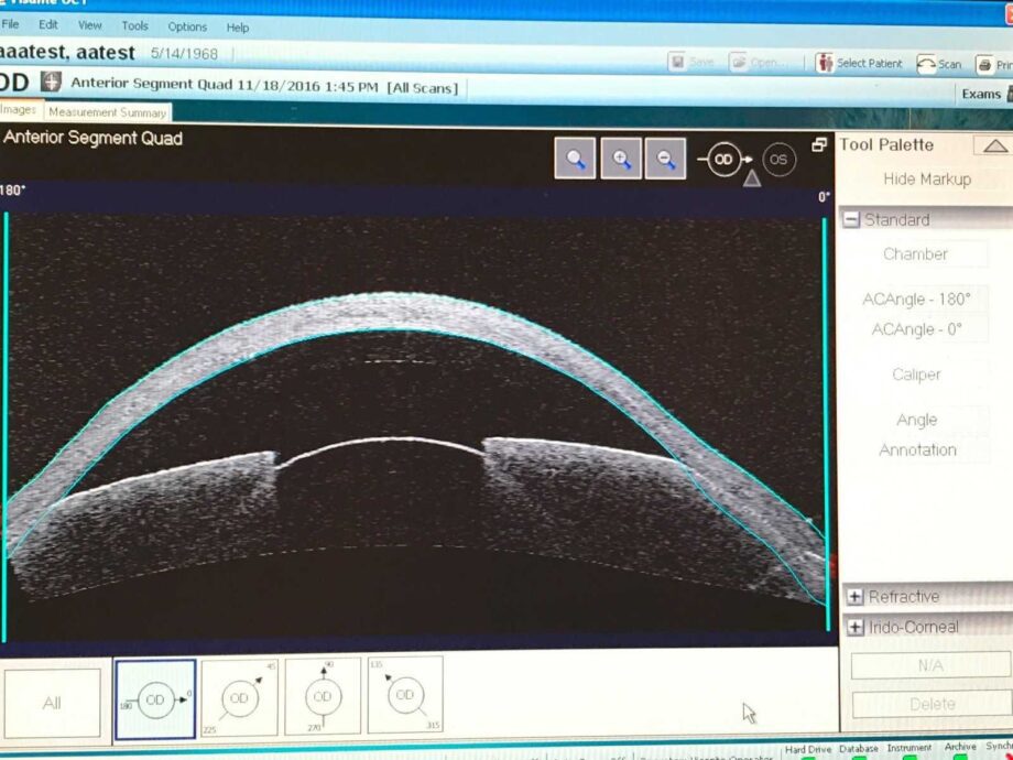 Carl Zeiss Visante OCT Anterior Segment Imaging and Biometry