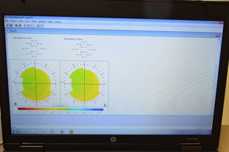 Topcon KR-8100 P