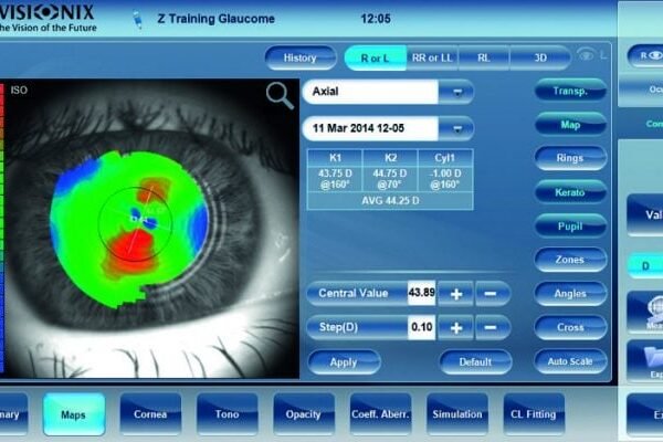 Visionix VX130 Autorefractometer