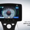 Zeiss VISUSCOUT 100 Handheld Fundus Camera