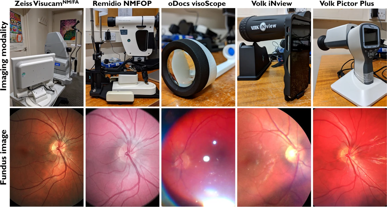 mydriatic vs non mydriatic fundus camera