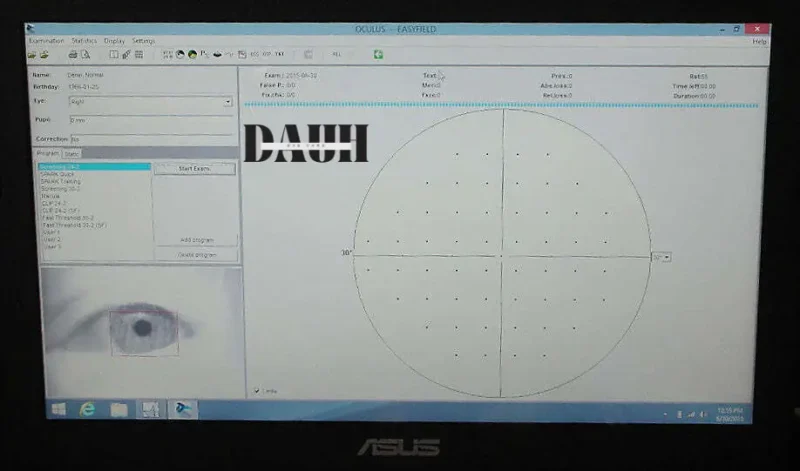 Oculus Easyfield
